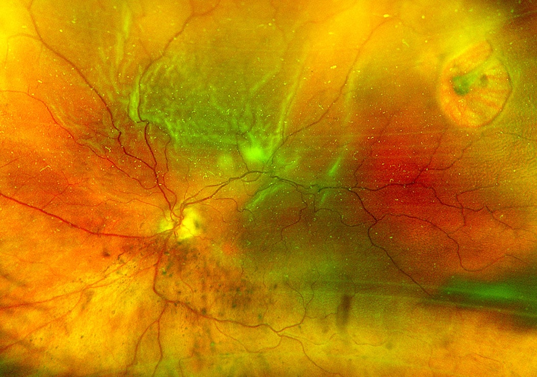 Odessa Eye Doctor - Optos Digital Imaging