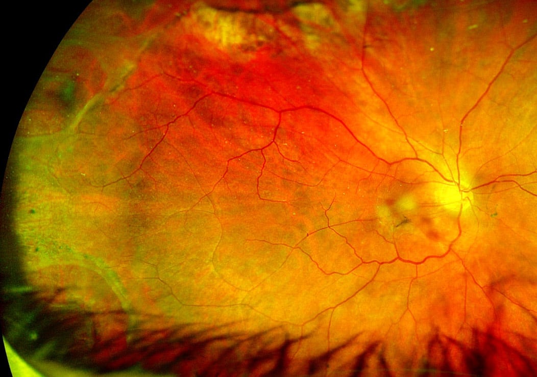 Odessa Eye Doctor - Optos Digital Imaging