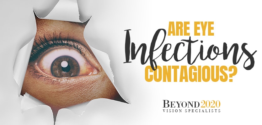 Are Eye Infections Contagious?