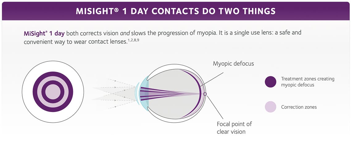MiSight 1-Day Contacts Near Me
